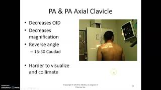 Clavicle