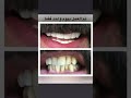 ابتسامه هوليود في العراق اربيل دكتوره دبنا قاسم مالك خريجه جامعه بغداد سنه ١٩٩٢ للحجز ٠٧٥٠٥٥٧٨٥٥٨ ابتسامه هوليود في العراق اربيل دكتوره دبنا قاسم مالك خريجه جامعه بغداد سنه ١٩٩٢ للحجز ٠٧٥٠٥٥٧٨٥٥٨