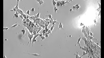 Optically Induced Neural Differentiation