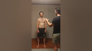 Static Postural Assessment