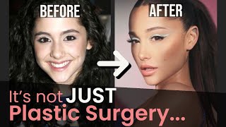 Plastic Surgery aside, here is how Ariana REALLY changed (Secret to her Glow Up!)