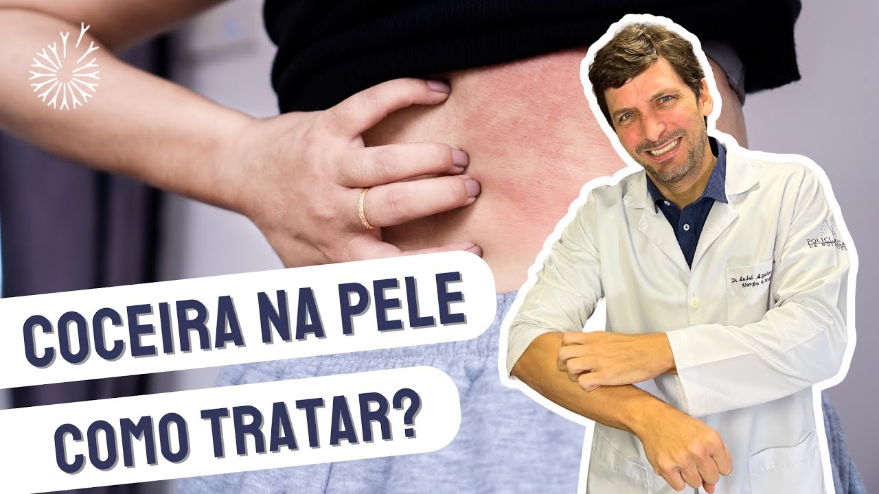 7 CAUSAS DE COCEIRA NA PELE E COMO TRATAR #coceira #dermatite # ...