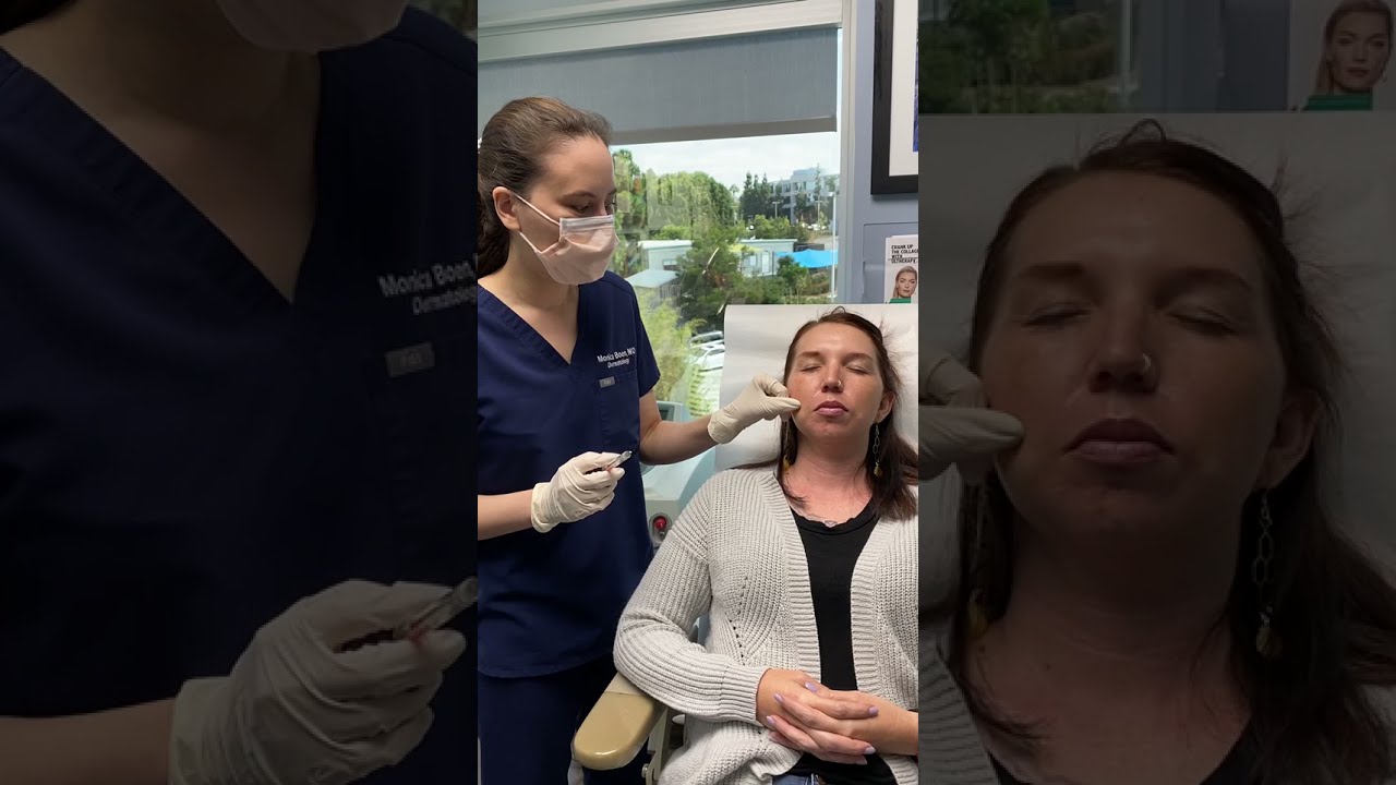 Banner for Safely Treat Signs of Aging With Restylane Dermal Fillers in San Diego