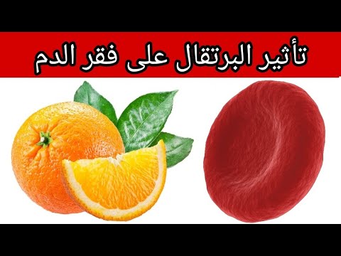 تأثير البرتقال على فقر الدم