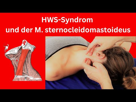 Video: 3 Möglichkeiten, Ihr Sternocleidomastoid zu entspannen