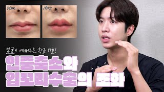 얼굴이 예뻐지는 황금 비율! 인중축소와 입꼬리수술의 조화