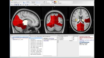 fsleyes atlases and roixtractor