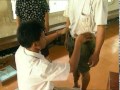 ICRC PRP Cambodia  Battambang's Prosthetic Workshop Transtibial Prosthesis