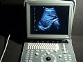 Echographe chison eco1 guide  lutilisation  centre daffaires medical