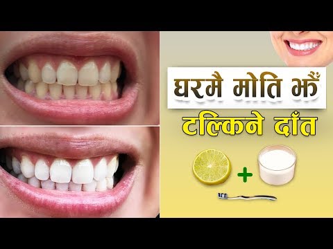 हेर्दै घिन लाग्ने पहेंलो दाँत  सजिलै यसरी सफा र चम्किलो पर्नुस् - Teeth Whitening Home Remedies