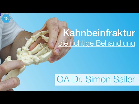 Video: Heilt eine Kahnbeinfraktur?