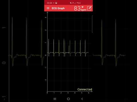 Heartbeat with ecg