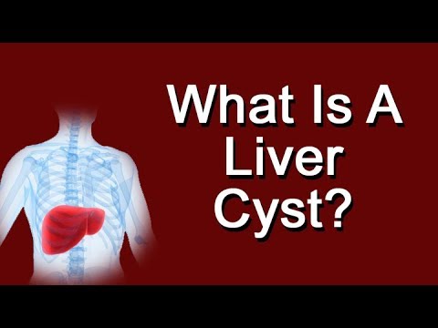 What Is A Liver Cyst? Are Liver Cysts Dangerous?