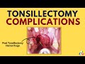 Tonsillectomy Complications
