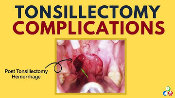 Tonsillectomy Complications