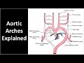 Aortic Arches Explained