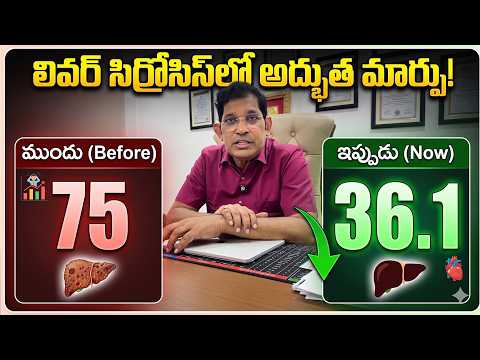లివర్ సిర్రోసిస్‌లో అద్భుత మార్పు | 75 నుంచి 36.1కి ఎలా తగ్గింది? Real Recovery Story |Dr Ravi Kumar