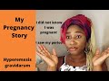 MY PREGNANCY STORY |  HYPEREMESIS GRAVIDARUM | I DID NOT KNOW I WAS PREGNANT