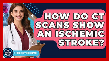 How Do CT Scans Show An Ischemic Stroke? - Stroke Support Channel