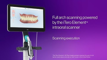 How to scan a full arch with the iTero Element™ Plus scanner | step-by-step execution