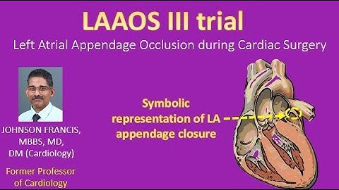 LAAOS III trial – Left Atrial Appendage Occlusion during Cardiac Surgery