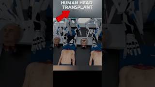 AI करेगा इंसान का सिर ट्रांसप्लांट! | Future of Medicine!! #AI #technology #factsinhindi #shorts