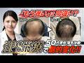 【50代男性の薄毛治療】「もう遅い」は間違い？iPS治療を組み合わせた8ヶ月の治療経過を解説