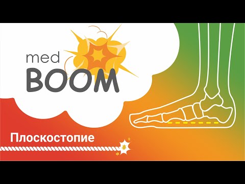 Плоскостопие и заболевания стоп. Лечение плоскостопия у детей и взрослых.