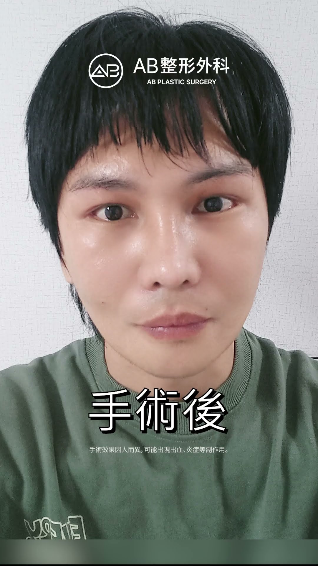 前後差別也太大了 #shorts