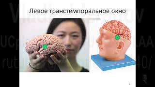 Клиническая и ультразвуковая  анатомия сосудов головного мозга. Запись 10.01.2023
