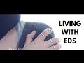 Living with Ehlers-Danlos Syndrome | The Unseen Truth of EDS [CC]