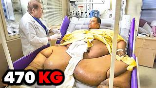 A Triste Vida da Pessoa Mais Obesa do Mundo
