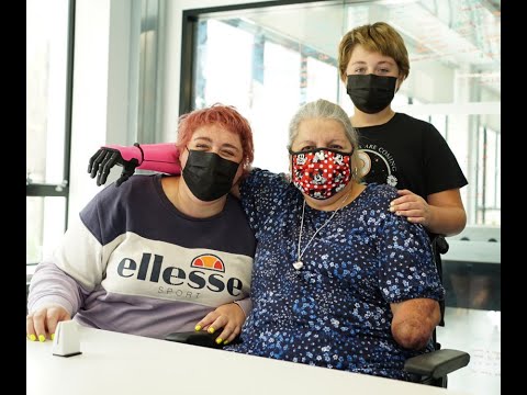 Mum Loses All Limbs to Sepsis - Gets Bionic Arm to Hug Family