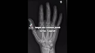 before you answer your sejarah paper 3