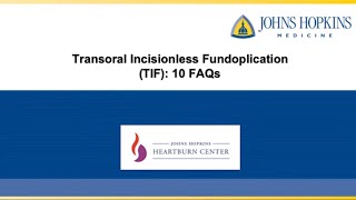 Transoral Incisionless Fundoplication (TIF) | FAQ's