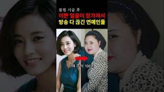 불법 시술을 받고 얼굴이 완전 망가진 연예인들!  #이슈 #연예인 #쇼츠