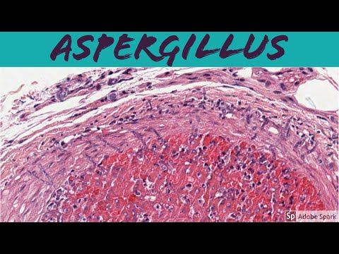 Видео: Aspergillus Alliaceus гэж юу вэ - Кактус дээрх иш, мөчрийн ялзралын талаар мэдэж аваарай