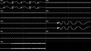 FNF: Vs. Sonic.EXE 2.0 - Chaos (Instrumental) YM2612   SN76489 Oscilloscope View