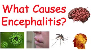 Encephalitis (Brain Inflammation) | Causes, Symptoms, Diagnosis, Treatment