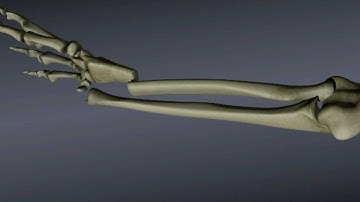 Reducing a Distal Radius Fracture