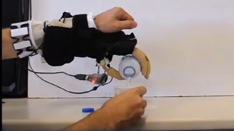 EMG based control of a soft prosthetic hand