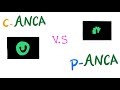 c-ANCA VS p-ANCA (Autoantibodies) | Autoimmune Diseases