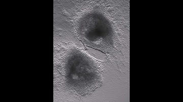 Heart cells in a dish