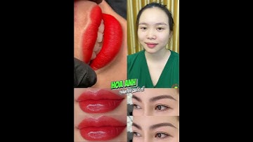 Tháng 11 hoa anh có gì | Thẩm mỹ viện hoa anh #thammyvienhoaanh #uudailon