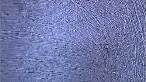 C2C12 spontaneous contractions