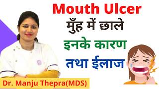 मुँह के छाले, कारण व ईलाज | Mouth Ulcer, reasons & Treatments | Dr. Manju Thepra