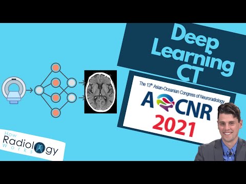 Deep Learning CT (Iterative Recon vs Deep Learning) [Part II/III of Nett AOCNR 2021]