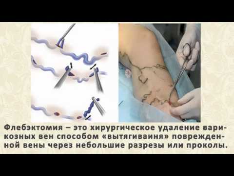 Покалывание в венах на руках