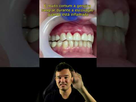 Vídeo: O que significa linguogengival?