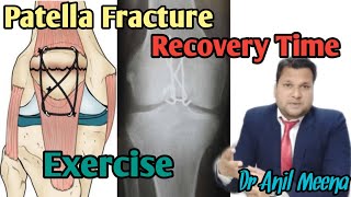 Patella Fracture Recovery Time after surgery | Patella Fracture  Recovery Exercises| In Hindi